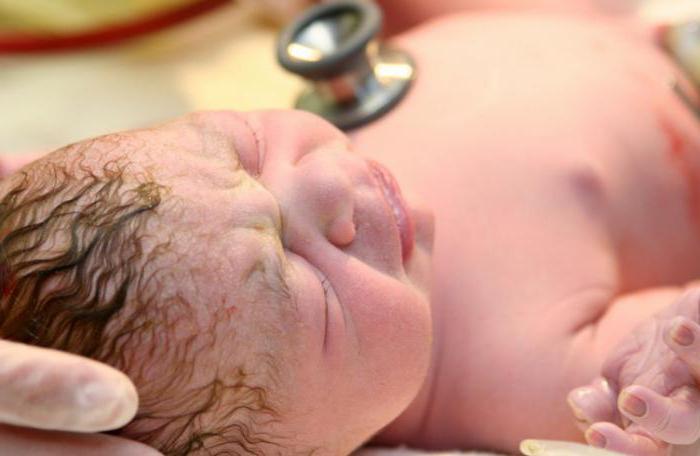 Silvermanova stupnice se používá k hodnocení novorozence