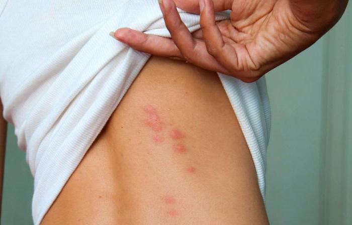 destruction de punaises de lit dans l'appartement