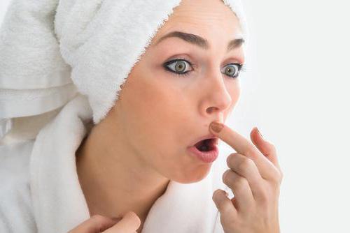 acne intorno alla bocca causa