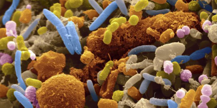 caratteristiche strutturali di una cellula batterica
