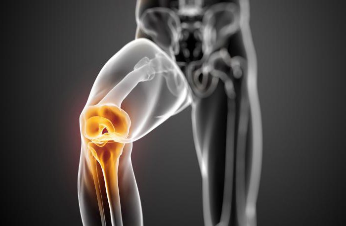 x-ray of the knee joint