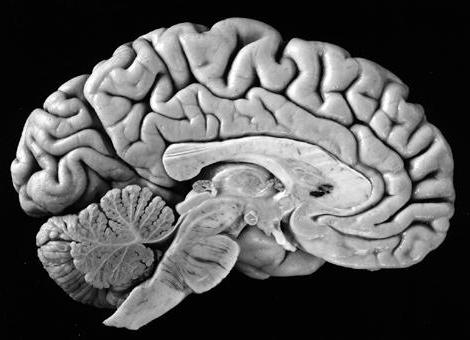 superficie degli emisferi cerebrali