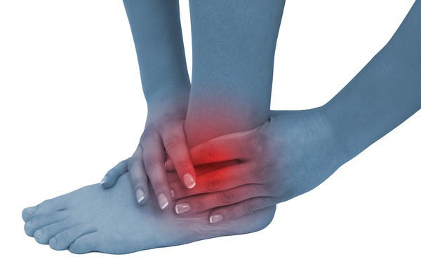 recensioni di artrodesi della caviglia