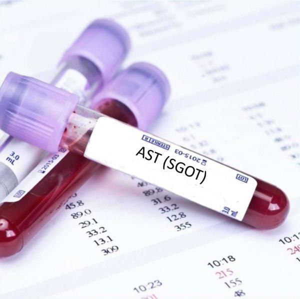 aminotransferase aspartate ast העלה את המשמעות של זה