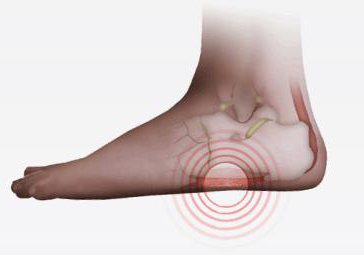 bolesti v noze mezi patou a léčbou špičky