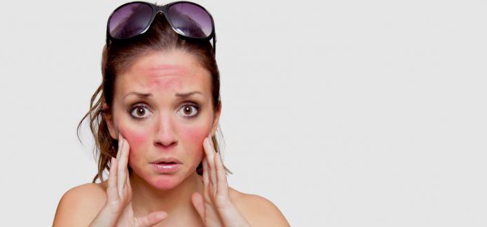 hvordan du behandler hudforbrenninger med blemmer