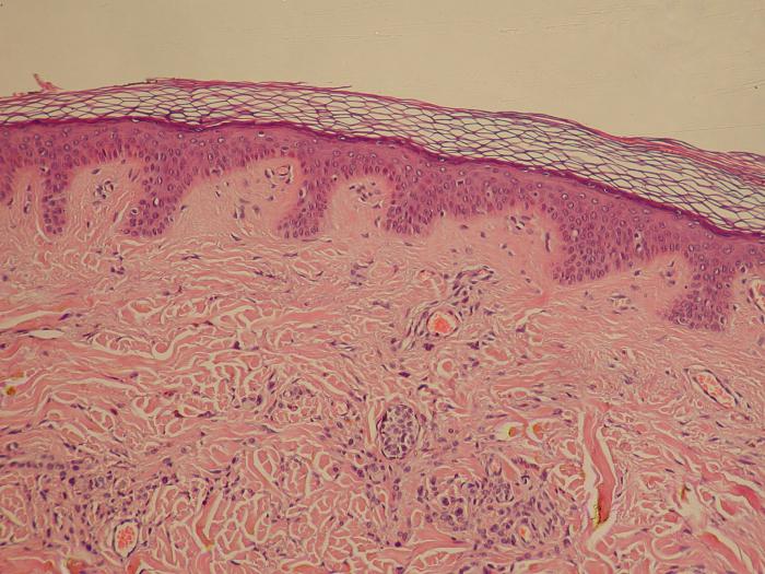 Epiderma umană