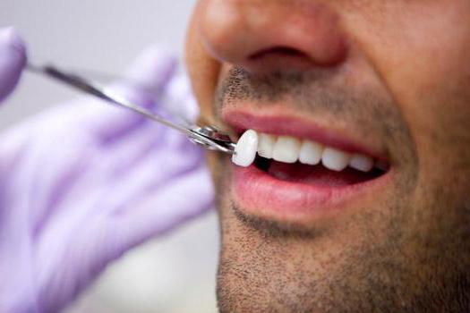 veneers ve lumineers arasındaki fark nedir 