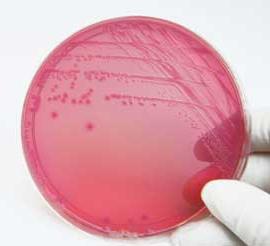 escherichia coli in uitstrijkje
