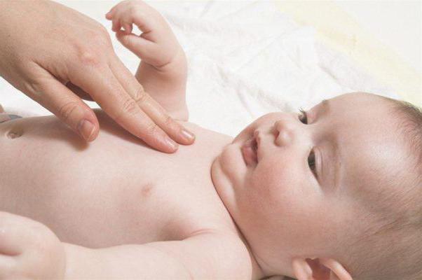 rickets in infants symptoms