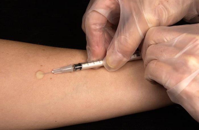 أين تفعل diaskintest في رد فعل SPB mantoux