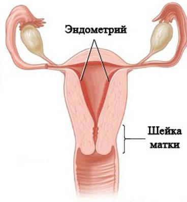 ความคิดเห็น hyperplasia เยื่อบุโพรงมดลูก