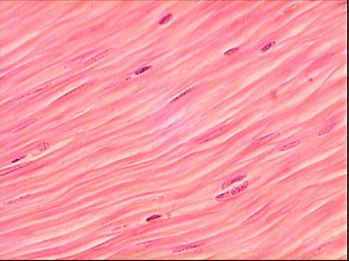 formas de tejido muscular estriado 