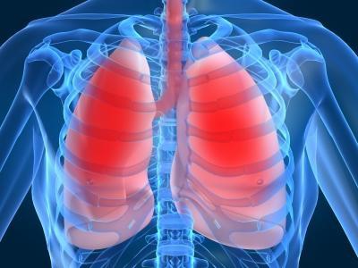 jak leczyć zapalenie płuc 