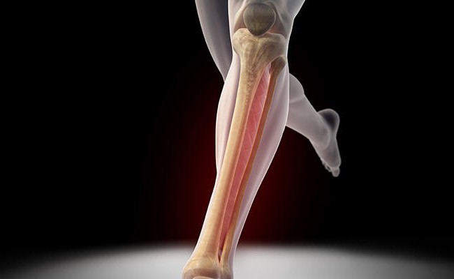 fratura dos ossos da perna