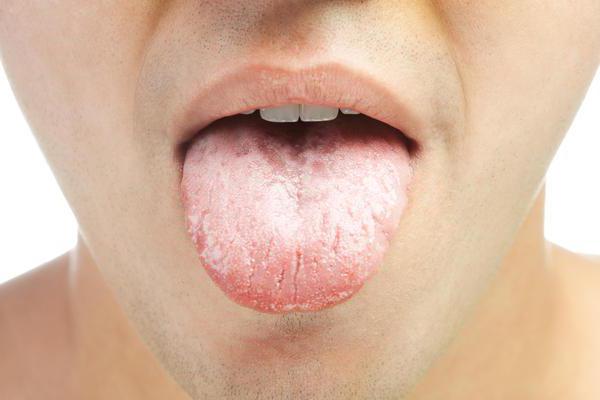 Gezwollen tong: oorzaken