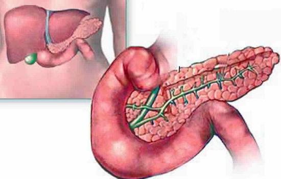 pancreas nekrose forårsaker