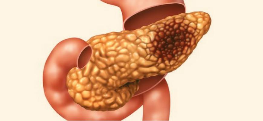 ตับอ่อนอักเสบทำให้การรักษาตามอาการ