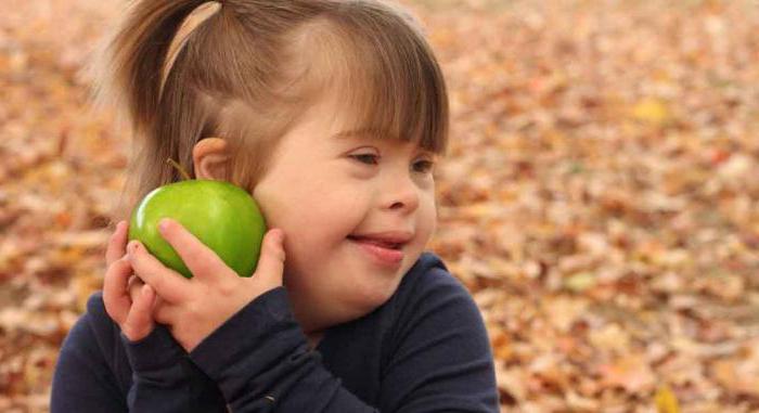 newborn children with down syndrome signs in a child