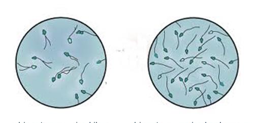 invitro spermogram