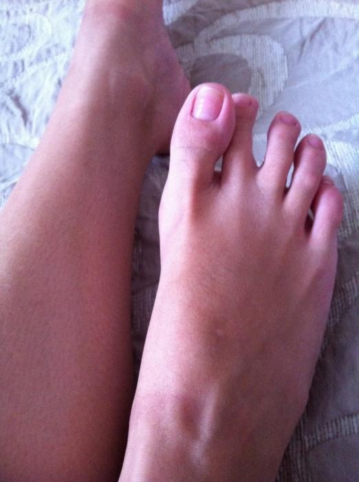 Degetele de la picioare contractate