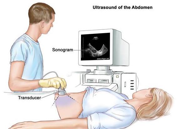 transabdominālā ultraskaņa ir