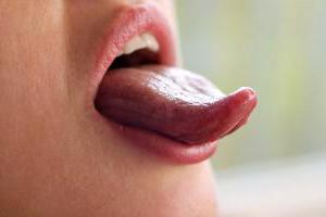 inflammation of the salivary gland under the tongue